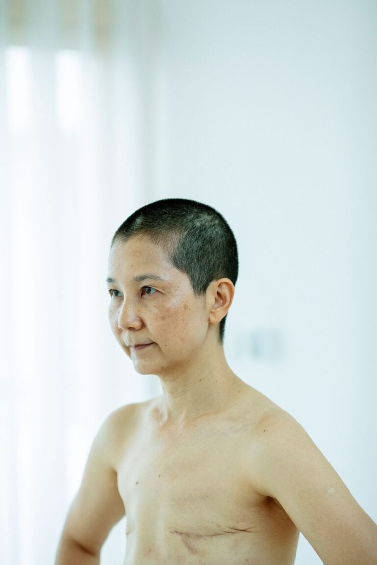 Confident topless mature ethnic female looking away in light room with scars on chest after breast removal surgery from cancer next to curtains on window