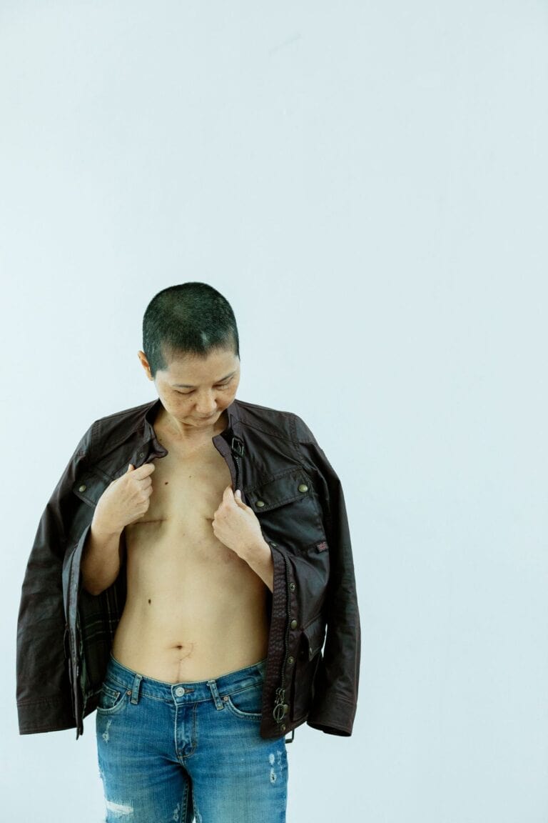 Serious Asian female in trendy outfit with naked torso and scars left after operated breast tumor standing against white background and looking down