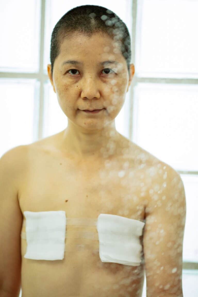 Thought glass serious elderly Asian woman with short dark hair and sterile bandages on breast looking at camera against light wall