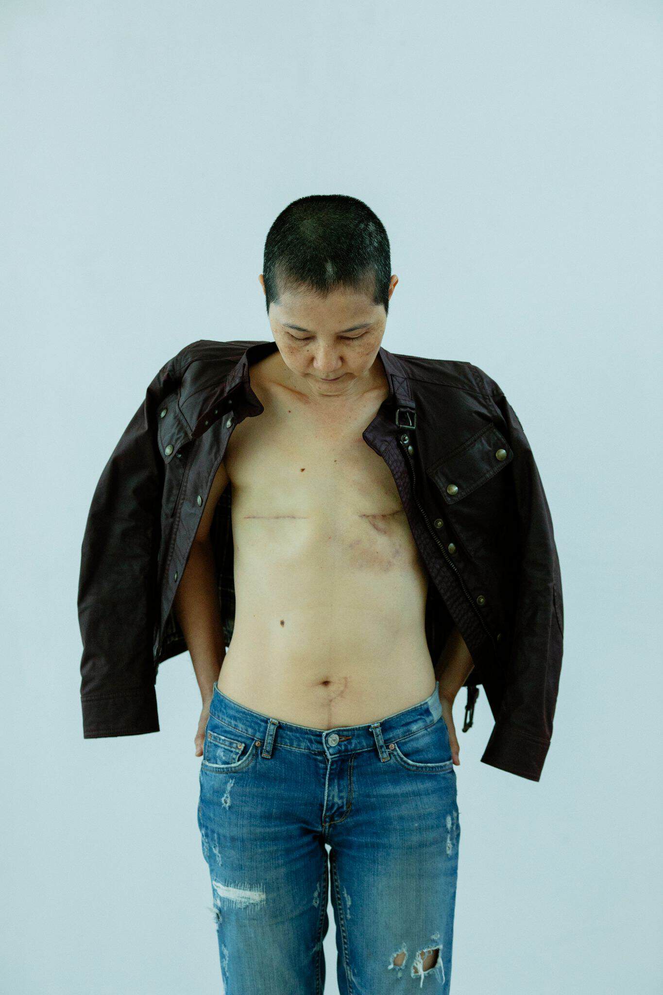 Om forfatteren Thoughtful mature ethnic female in jacket and jeans standing in light studio with scars on chest after breast removal surgery from cancer on white background